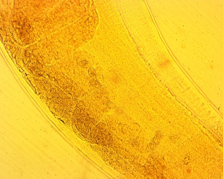 Human whipworm (Trichuris trichiura) female - permanent slide plate under high magnification