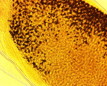 Human whipworm (Trichuris trichiura) female - permanent slide plate under high magnification