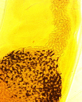 Human whipworm (Trichuris trichiura) female - permanent slide plate under high magnification