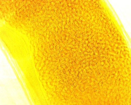 Human whipworm (Trichuris trichiura) female - permanent slide plate under high magnification
