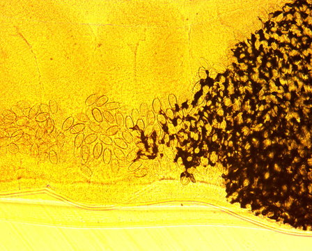 Human whipworm (Trichuris trichiura) female - permanent slide plate under high magnification