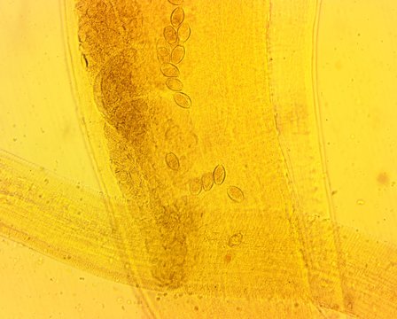 Human whipworm (Trichuris trichiura) female - permanent slide plate under high magnification