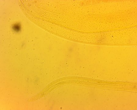 Human whipworm (Trichuris trichiura) female - permanent slide plate under high magnification