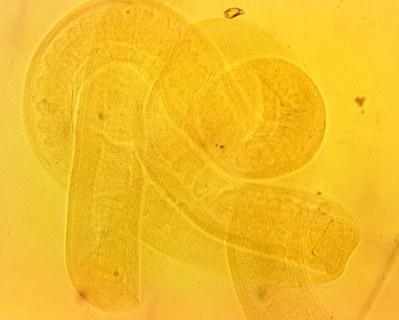 Human whipworm (Trichuris trichiura) female - permanent slide plate under high magnification