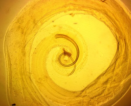 Human whipworm (Trichuris trichiura) male - permanent slide plate under high magnification