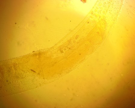 Human whipworm (Trichuris trichiura) male - permanent slide plate under high magnification