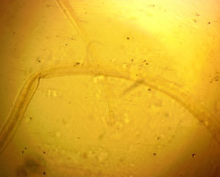 Human whipworm (Trichuris trichiura) male - permanent slide plate under high magnification