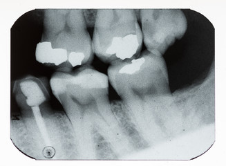 dental xray