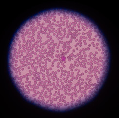 red blood cells under microscope in medical background concept.