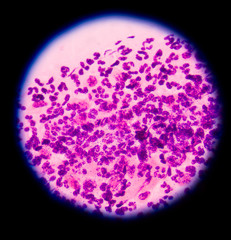 Obraz na płótnie Canvas blood cells