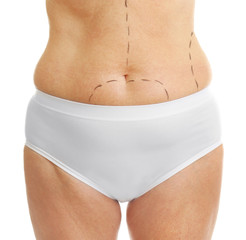 Female body with marks for plastic correction on white background