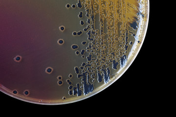 Black bacterial colonies of Salmonella species on Salmonella Shi