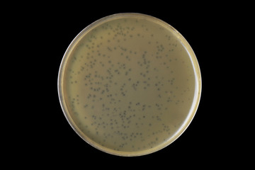 Bacteriophage plaques (clear zone) within the lawn bacterial aga