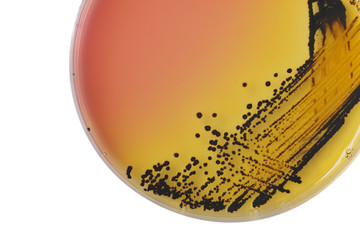 Black bacterial colonies of Salmonella species on Salmonella Shi