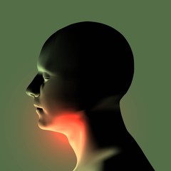 Laryngitis vector illustration. Human throat irritation. - 125964106