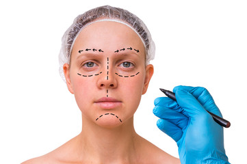 Doctor makes dotted lines on female face for cosmetic face lift