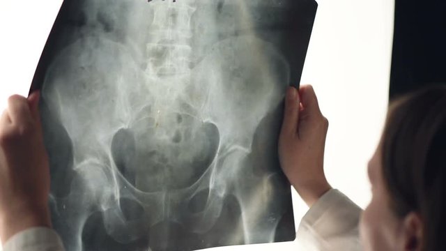 Female doctor examining pelvis x-ray in hospital office, medical professional in white uniform analyzing hip image in clinic.