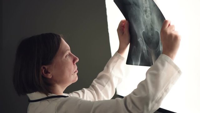 Female doctor examining pelvis x-ray in hospital office, medical professional in white uniform analyzing hip image in clinic.