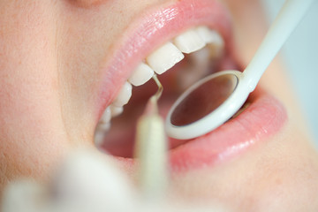 Close-up of woman at the dentist
