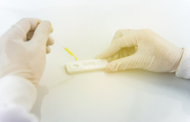 Set of laboratory test,Blood sample test in laboratory