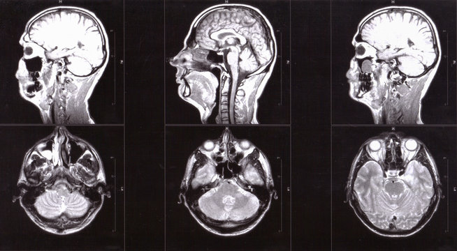 Magnetic resonance image (MRI) of the human brain