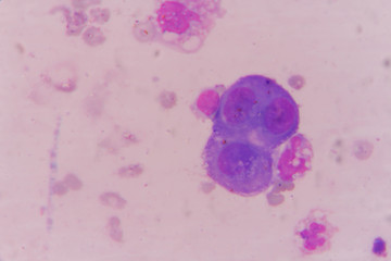 mesothelial cell