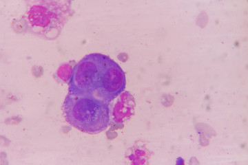 mesothelial cell
