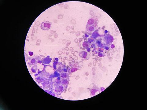 mesothelial cell