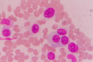 plasma cells