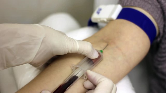 Sampling the patient's blood into the vial