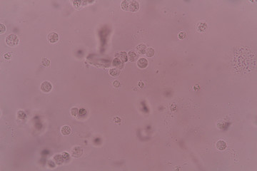 white blood cell clumping in urine