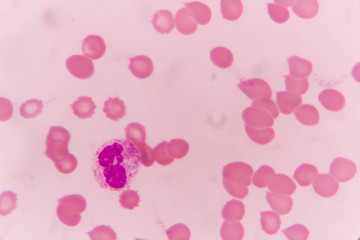 Neutrophil human blood cell under microscope,complete blood count.
