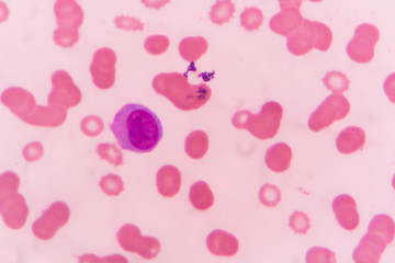 slide blood smear show plasme cell for complete blood count