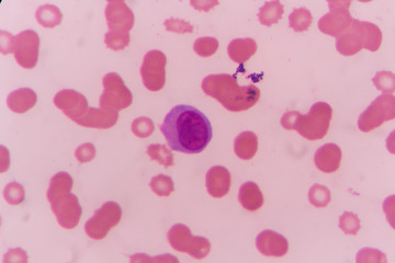 complete blood count