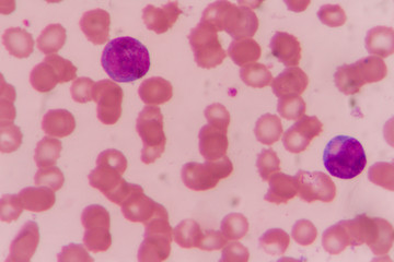 complete blood count