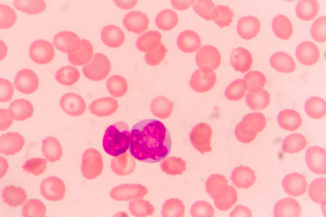 slide blood smear show monocyte for complete blood count