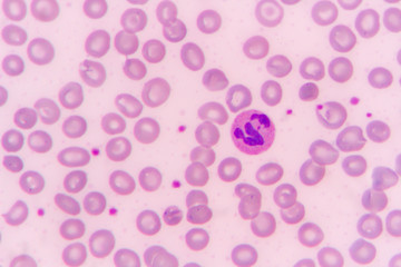 slide blood smear show neutrophil for complete blood count