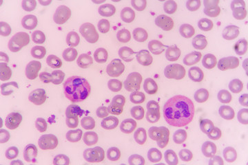 slide blood smear show neutrophil for complete blood count
