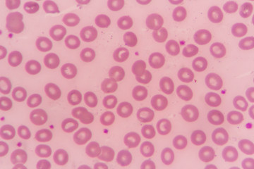Normal red blood cells.