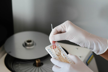 blood sample for hematocrit testing