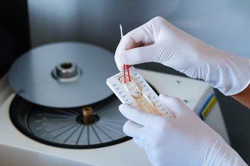 blood sample for hematocrit testing