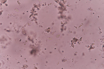 Giardia lamblia cyst under light microscopy