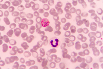 Malaria parasite P. vivax - obrazy, fototapety, plakaty
