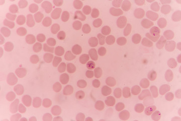 plasmodium falciparum ring form state , multiple in fection of red blood cells