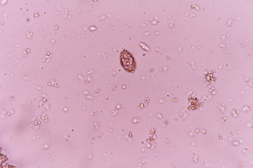 opisthorchis viverrini egg