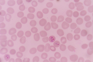 plasmodium falciparum  infections red blood cells