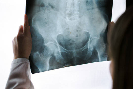Female doctor examining pelvis x-ray in hospital office