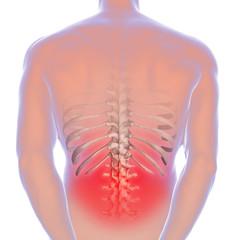 Sciatica - lower back pain