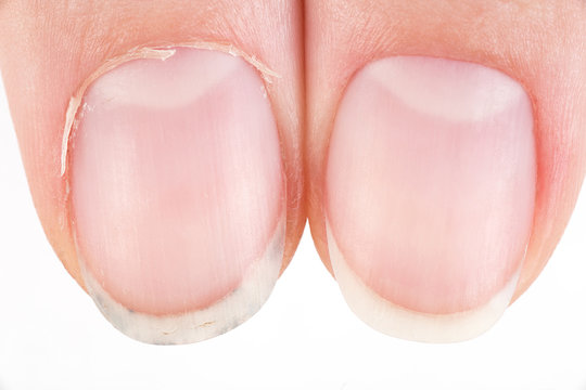 Cuticles Images – Browse 1,690,439 Stock Photos, Vectors, and Video ...