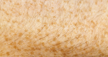 skin of the human hand